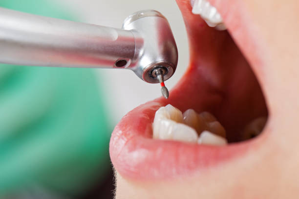 Best Emergency Dental Care for Trauma or Injury in Wakeeney, KS
